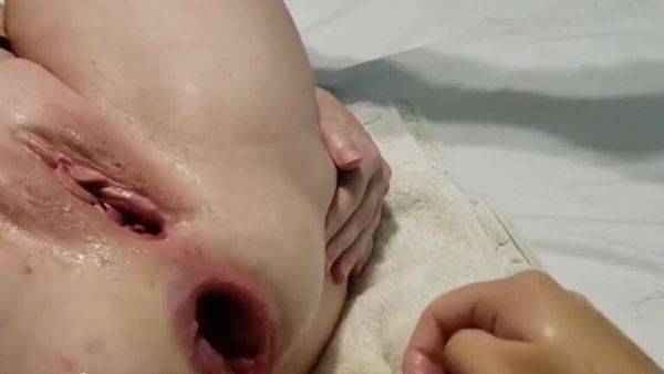 Bbw fisting mature slut - upornia.com on poweredporn.com