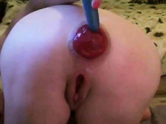 PROLAPSE-A-LICIOUS 2 - drtuber.com on poweredporn.com