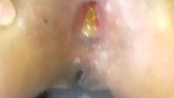 Daddy Stretches Teen's Big Ass Wide Open - Rough Anal Sex with Colombian Culona - xxxfiles.com - Colombia on poweredporn.com